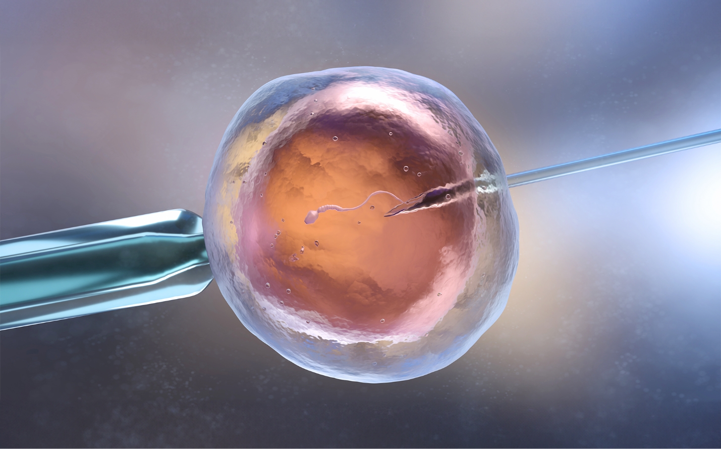 시험관아기 시술 이미지, 난자와 정자 수정 및 미세수정 과정을 표현한 체외수정 IVF 남성난임 치료 의료 이미지