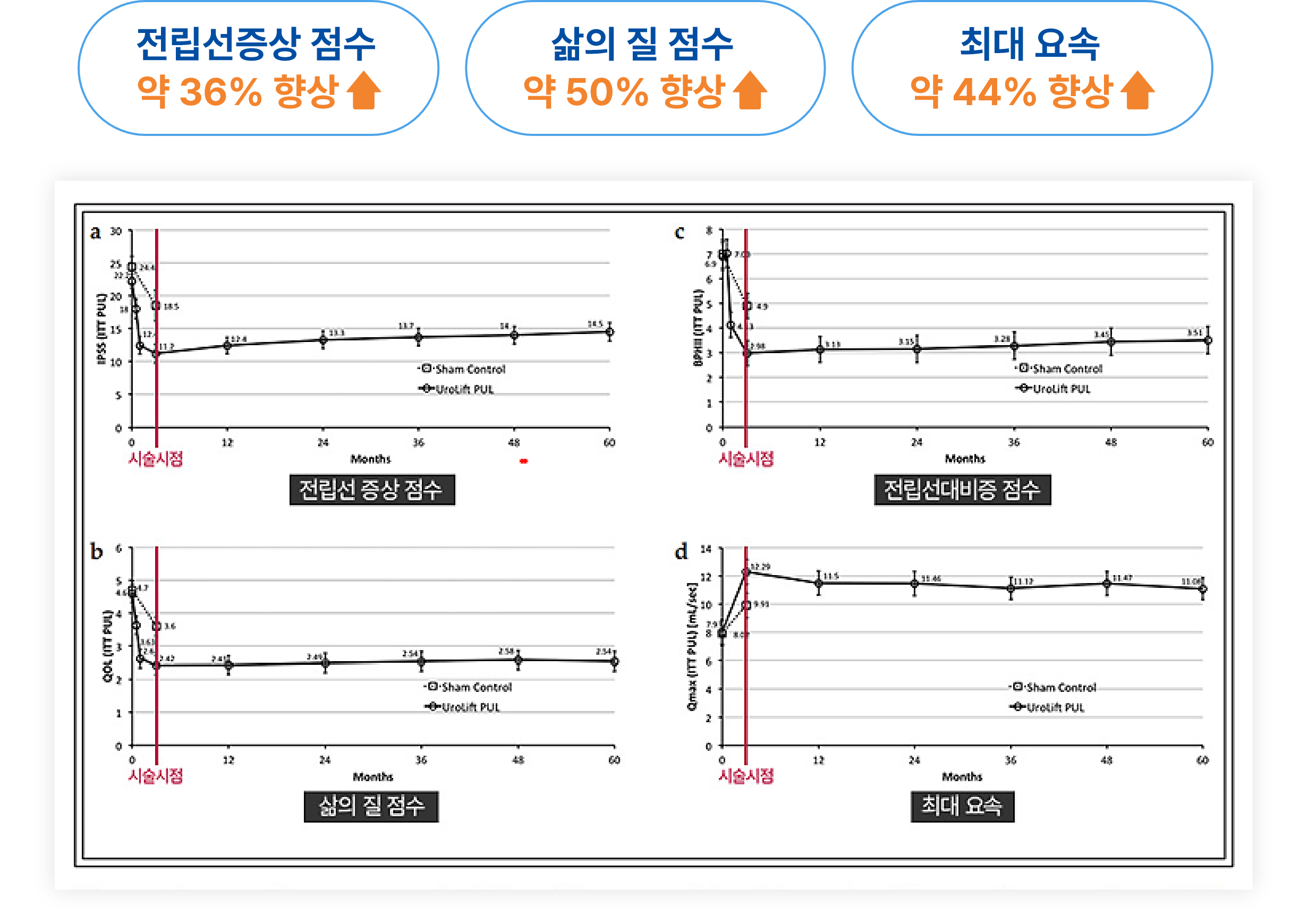 전립선비대증 치료 후 5년간 전립선 증상 점수와 삶의 질, 요속 변화 지표를 보여주는 논문 기반 그래프 이미지
