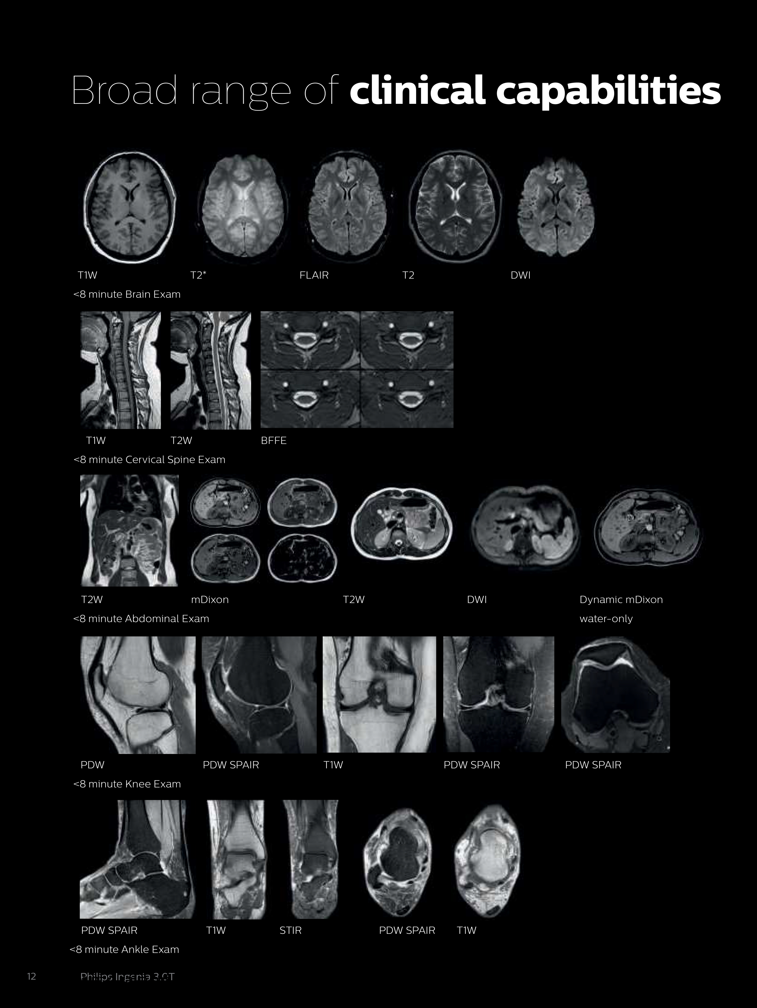 인체 촬영 결과를 통해 관절 및 조직 상태를 확인하는 MRI 영상 사례