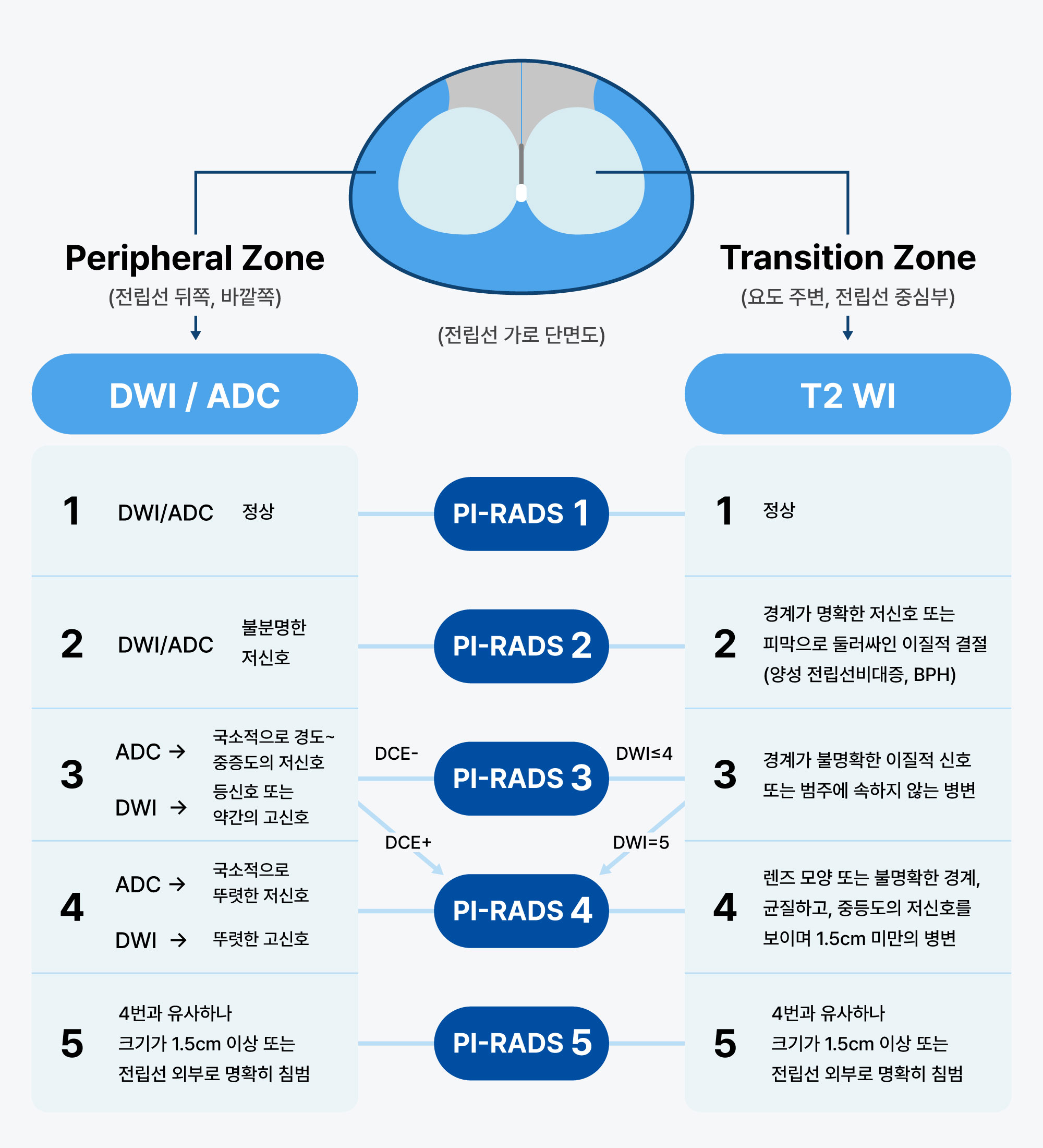 전립선 MRI 검사 이미지 - DWI ADC 영상과 PI-RADS 기준을 활용해 전립선암 의심 정도를 단계별로 평가하는 정밀 진단 설명