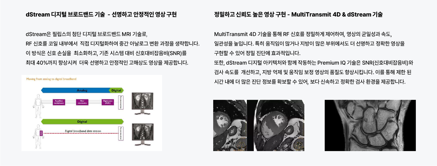 신호 손실을 최소화하고 SNR을 향상시킨 첨단 dStream MRI 디지털 영상 기술