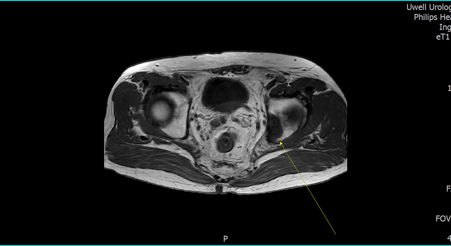 MRI 영상 판독을 통한 이상 여부 확인 및 향후 치료 방향 결정