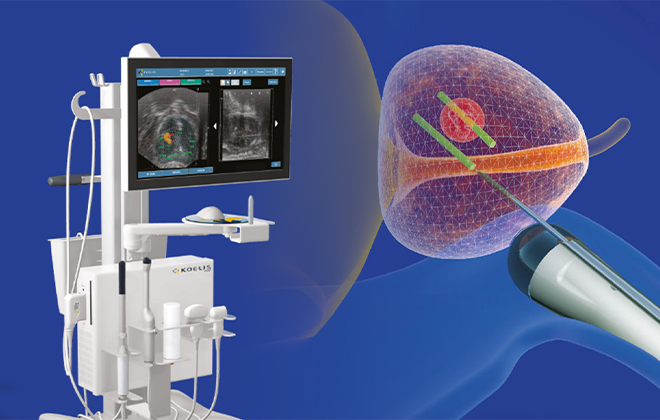 PSA 검사와 MRI, MRI 유도 조직검사를 표현한 전립선암 정밀 검사