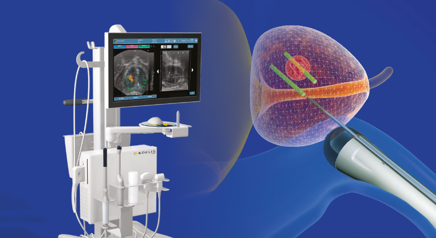 전립선암 MRI 융합 표적 조직검사 시스템 이미지, MRI와 초음파 영상을 융합해 암 의심 부위를 정밀 조준하는 조직검사 장비