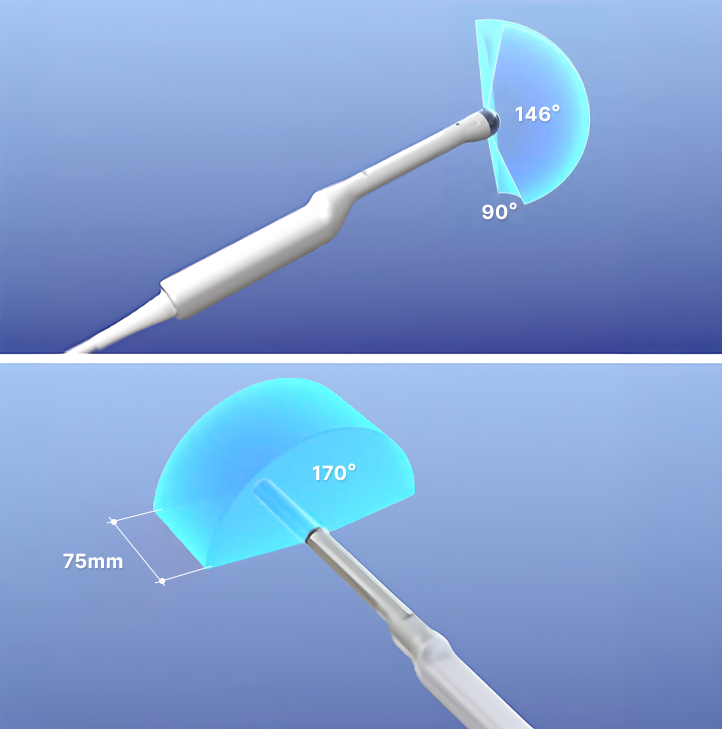전립선 3D 초음파 프로브 이미지 전체 전립선 구조를 입체적으로 확인하는 검사 장비